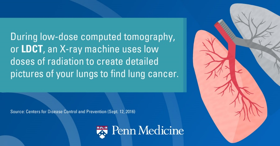 7 Facts About Lung Cancer Screening | Penn Medicine